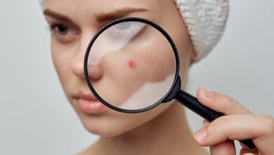 Vitamin E For Pimples: Is It Environment friendly?