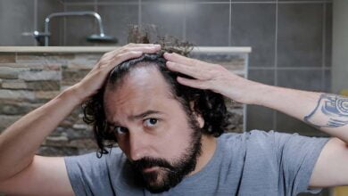 Hair transplant: an effective solution against baldness?