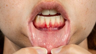 Gum Disease: The Silent Destroyer and How to Fight It Naturally