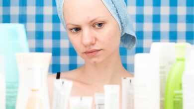 How to Get Rid of Acne