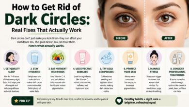 How to Get Rid of Dark Circles